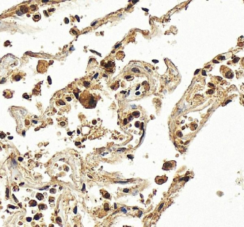 IHC staining of FFPE human liver tissue with Hexokinase 3 antibody, HRP-secondary and DAB substrate. HIER: boil tissue sections in pH8 EDTA for 20 min and allow to cool before testing.