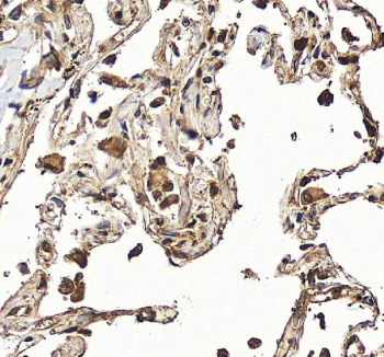 IHC staining of FFPE human liver tissue with Hexokinase 3 antibody, HRP-secondary and DAB substrate. HIER: boil tissue sections in pH8 EDTA for 20 min and allow to cool before testing.