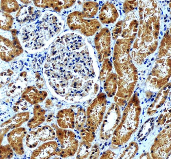 IHC staining of FFPE human kidney tissue with AP2M1 antibody, HRP-secondary and DAB substrate. HIER: boil tissue sections in pH8 EDTA for 20 min and allow to cool before testing.