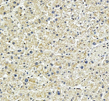 IHC staining of FFPE human liver tissue with SPRED2 antibody, HRP-secondary and DAB substrate. HIER: boil tissue sections in pH8 EDTA for 20 min and allow to cool before testing.