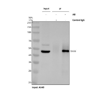 Immunoprecipitation of SNX6 protein from 500ug of human A549 whole cell lysate with 2ug of SNX6 antibody.