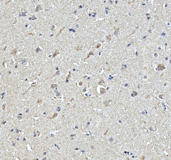 IHC staining of FFPE human brain tissue with STON2 antibody, HRP-secondary and DAB substrate. HIER: boil tissue sections in pH8 EDTA for 20 min and allow to cool before testing.