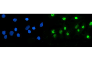 Immunofluorescent staining of FFPE human A549 cells with USP5 antibody (green) and DAPI nuclear stain (blue). HIER: steam section in pH6 citrate buffer for 20 min.