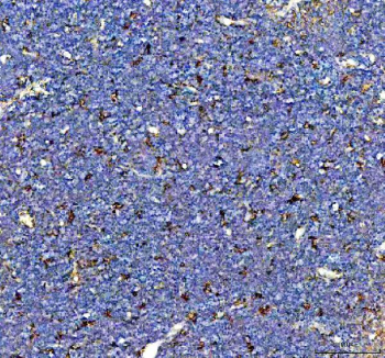 IHC staining of FFPE rat thymus tissue with Cd163 antibody, HRP-secondary and DAB substrate. HIER: boil tissue sections in pH8 EDTA for 20 min and allow to cool before testing.
