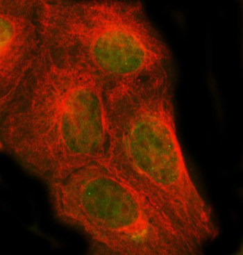 Immunofluorescent staining of FFPE human U-2 OS cells with PSMC1 antibody (green) and Beta Tubulin mAb (red). HIER: steam section in pH6 citrate buffer for 20 min.
