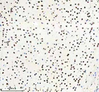 IHC staining of FFPE mouse brain tissue with PABPN1 antibody, HRP-secondary and DAB substrate. HIER: boil tissue sections in pH8 EDTA for 20 min and allow to cool before testing.