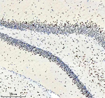 IHC staining of FFPE rat brain tissue with PABPN1 antibody, HRP-secondary and DAB substrate. HIER: boil tissue sections in pH8 EDTA for 20 min and allow to cool before testing.