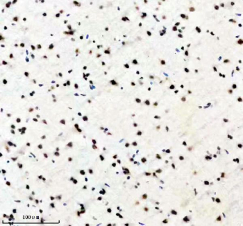 IHC staining of FFPE rat brain tissue with PABPN1 antibody, HRP-secondary and DAB substrate. HIER: boil tissue sections in pH8 EDTA for 20 min and allow to cool before testing.