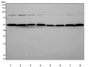 Western blot testing of 1) human HepG2, 2) human RT-4, 3) human MCF7, 4) human Jurkat, 5) rat C6, 6) rat PC-12, 7) mouse RAW264.7 and 8) mouse Neuro-2a cell lysate with PABPN1 antibody. Predicted molecular weight ~35 kDa, but the protein is commonly observed at ~50 kDa due to its acidic, low-SDS-binding N-terminus and arginine-rich C-terminus.