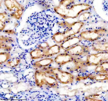 IHC staining of FFPE human kidney tissue with TRAIL-R4 antibody, HRP-secondary and DAB substrate. HIER: boil tissue sections in pH8 EDTA for 20 min and allow to cool before testing.