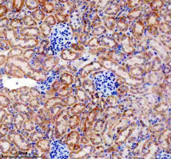 IHC staining of FFPE mouse kidney tissue with TRAIL-R4 antibody, HRP-secondary and DAB substrate. HIER: boil tissue sections in pH8 EDTA for 20 min and allow to cool before testing.