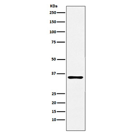 Western blot testing of human prostate tissue lysate with TRAIL-R4 antibody. Predicted molecular weight ~42 kDa.