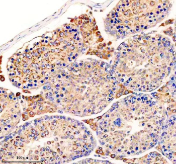 IHC staining of FFPE mouse testis tissue with UPF1/Up-frameshift suppressor 1 antibody, HRP-secondary and DAB substrate. HIER: boil tissue sections in pH8 EDTA for 20 min and allow to cool before testing.