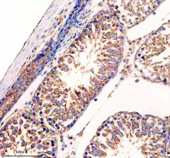 IHC staining of FFPE rat testis tissue with UPF1/Up-frameshift suppressor 1 antibody, HRP-secondary and DAB substrate. HIER: boil tissue sections in pH8 EDTA for 20 min and allow to cool before testing.