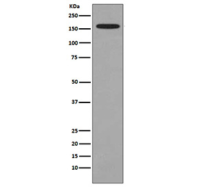 Western blot testing of mouse RAW264.7 cell lysate with DOT1L antibody. Predicted molecular weight ~165 kDa.