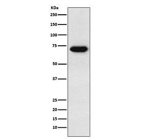 Western blot testing of human placental tissue lysate with CD39 antibody. Expected molecular weight: 34-100 kDa depending on isoform and level of glycosylation.