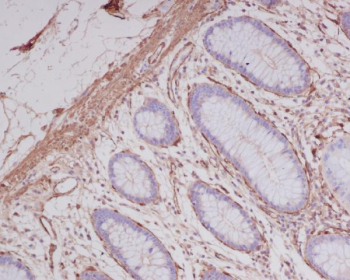 IHC staining of FFPE human colon tissue with ACTA2 antibody, HRP-secondary and DAB substrate. HIER: boil tissue sections in pH8 EDTA for 20 min and allow to cool before testing.