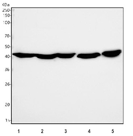 Western blot testing of 1) human A431, 2) human A549, 3) human HeLa, 4) rat C6 and 5) mouse NIH 3T3 cell lysate using Alpha Actin antibody. Predicted molecular weight ~42 kDa.