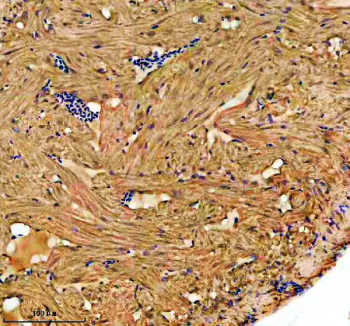 Zebrafish ILK Antibody Heart IHC. Immunohistochemistry staining of FFPE zebrafish heart tissue with Zebrafish ILK antibody. HIER: boil tissue sections in pH8 EDTA for 20 min and allow to cool before testing.