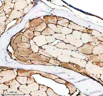 Zebrafish ILK Antibody Muscle IHC. Immunohistochemistry staining of FFPE zebrafish muscle tissue with Zebrafish ILK antibody. HIER: boil tissue sections in pH8 EDTA for 20 min and allow to cool before testing.