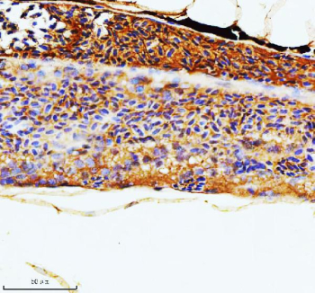 Zebrafish Rac1 Antibody Kidney IHC. Immunohistochemistry staining of FFPE zebrafish kidney tissue with Zebrafish Rac1 antibody. HIER: boil tissue sections in pH8 EDTA for 20 min and allow to cool before testing.