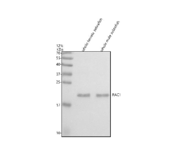 Zebrafish Rac1 Antibody WB. Western blot analysis of Rac1 protein using Rac1 antibody and 1) whole female zebrafish and 2) whole male zebrafish tissue lysate. Expected molecular weight ~22 kDa.