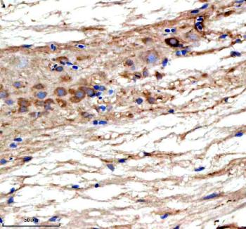 Zebrafish Ttc28 Antibody Spinal Cord IHC. Immunohistochemical analysis of Ttc28 protein using Ttc28 antibody and paraffin-embedded zebrafish spinal cord tissue. HIER: boil tissue sections in pH8 EDTA for 20 min and allow to cool before testing.