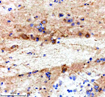 Zebrafish Ttc28 Antibody Brain IHC. Immunohistochemical analysis of Ttc28 protein using Ttc28 antibody and paraffin-embedded zebrafish brain tissue. HIER: boil tissue sections in pH8 EDTA for 20 min and allow to cool before testing.