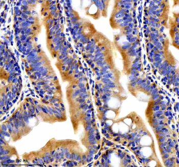 Zebrafish Ttc28 Antibody Colon IHC. Immunohistochemical analysis of Ttc28 protein using Ttc28 antibody and paraffin-embedded zebrafish colon tissue. HIER: boil tissue sections in pH8 EDTA for 20 min and allow to cool before testing.