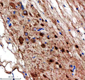 Zebrafish Nedd8 Antibody Spinal Cord IHC. Immunohistochemical analysis of Nedd8/8L protein using Nedd8 antibody and paraffin-embedded zebrafish spinal cord tissue. HIER: boil tissue sections in pH8 EDTA for 20 min and allow to cool before testing.