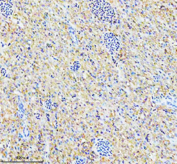 Zebrafish Pgk1 Antibody liver IHC. Immunohistochemistry staining of FFPE zebrafish liver tissue with Zebrafish Pgk1 antibody. HIER: boil tissue sections in pH8 EDTA for 20 min and allow to cool before testing.