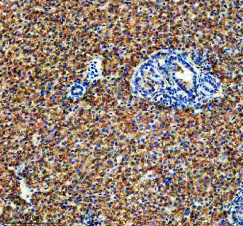 Zebrafish Idh3b Antibody Liver IHC. Immunohistochemical analysis of Idh3b protein using Zebrafish Idh3b antibody and paraffin-embedded zebrafish liver tissue. HIER: boil tissue sections in pH8 EDTA for 20 min and allow to cool before testing.