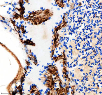 Zebrafish Idh3b Antibody Heart IHC. Immunohistochemical analysis of Idh3b protein using Zebrafish Idh3b antibody and paraffin-embedded zebrafish heart tissue. HIER: boil tissue sections in pH8 EDTA for 20 min and allow to cool before testing.