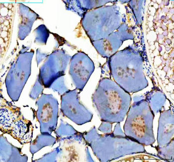 Zebrafish Dmrt1 Antibody Ovary IHC. Immunohistochemical analysis of Zebrafish Dmrt1 protein using Zebrafish Dmrt1 antibody and zebrafish ovary tissue. HIER: boil tissue sections in pH8 EDTA for 20 min and allow to cool before testing.