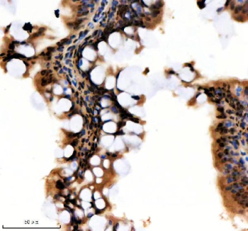 Zebrafish Hnrnpa1 Antibody Colon IHC. Immunohistochemical analysis of Hnrnpa1a/b protein using Zebrafish Hnrnpa1 antibody and paraffin-embedded zebrafish colon tissue. HIER: boil tissue sections in pH8 EDTA for 20 min and allow to cool before testing.