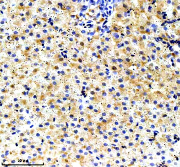 Zebrafish Ube2n Antibody Liver IHC. Immunohistochemistry staining of FFPE Zebrafish liver tissue with Ube2n antibody. HIER: boil tissue sections in pH8 EDTA for 20 min and allow to cool before testing.