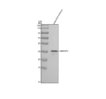Zebrafish Hnrnpd Antibody WB. Western blot testing of zebrafish embryo lysate with Zebrafish Hnrnpd antibody. Predicted molecular weight ~35 kDa.