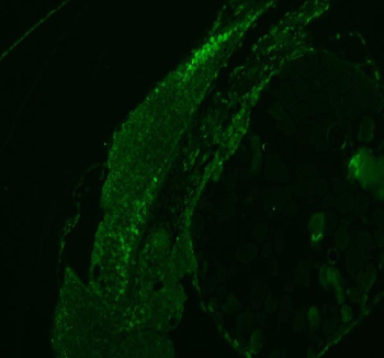 Zebrafish Hnrnpd Antibody Embryo IF. Immunofluorescent analysis of Hnrnpd protein using Zebrafish Hnrnpd antibody (green) and zebrafish embryo tissue. HIER: boil tissue sections in pH8 EDTA for 20 min and allow to cool before testing.