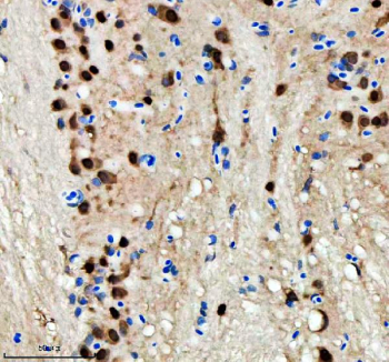 Zebrafish Hnrnpd Antibody Cerebellum IHC. Immunohistochemistry staining of FFPE zebrafish cerebellum tissue with Zebrafish Hnrnpd antibody. HIER: boil tissue sections in pH8 EDTA for 20 min and allow to cool before testing.