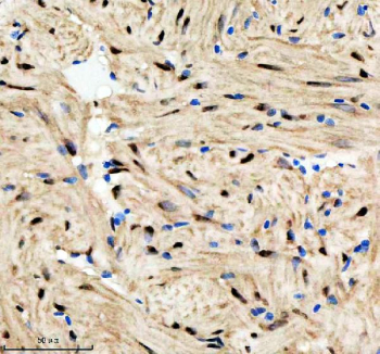 Zebrafish Hnrnpd Antibody Heart IHC. Immunohistochemistry staining of FFPE zebrafish heart tissue with Zebrafish Hnrnpd antibody. HIER: boil tissue sections in pH8 EDTA for 20 min and allow to cool before testing.