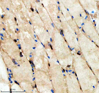 Zebrafish Hnrnpd Antibody Muscle IHC. Immunohistochemistry staining of FFPE zebrafish muscle tissue with Zebrafish Hnrnpd antibody. HIER: boil tissue sections in pH8 EDTA for 20 min and allow to cool before testing.