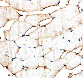 Zebrafish Srsf1 Antibody Skeletal Muscle IHC. Immunohistochemical analysis of Srsf1a/b protein using Zebrafish Srsf1 antibody and paraffin-embedded zebrafish skeletal muscle tissue. HIER: boil tissue sections in pH8 EDTA for 20 min and allow to cool before testing.