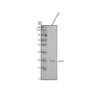 Zebrafish Lims1 Antibody WB. Western blot analysis of Lims1 protein using Zebrafish Lims1 antibody and zebrafish head tissue lysate. The predicted molecular weight of Lims1 is ~37 kDa.