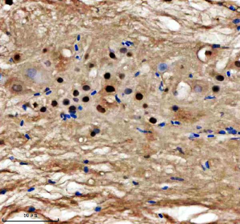 Zebrafish Ints12 Antibody Spinal Cord IHC. Immunohistochemical analysis of Ints12 protein using Zebrafish Ints12 antibody and paraffin-embedded zebrafish spinal cord tissue. HIER: boil tissue sections in pH8 EDTA for 20 min and allow to cool before testing.