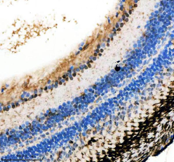 Zebrafish Ints12 Antibody Eye IHC. Immunohistochemical analysis of Ints12 protein using Zebrafish Ints12 antibody and paraffin-embedded zebrafish eye tissue. HIER: boil tissue sections in pH8 EDTA for 20 min and allow to cool before testing.