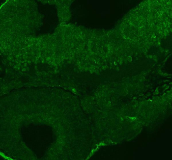 Zebrafish Ints12 Antibody Embryo IF. Immunofluorescent staining of FFPE zebrafish embryo tissue with Zebrafish Ints12 antibody (green). HIER: steam section in pH8 EDTA buffer for 20 min.