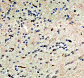 Zebrafish Hdac1 Antibody Brain IHC. Immunohistochemical analysis of Hdac1 protein using Zebrafish Hdac1 antibody and paraffin-embedded zebrafish brain tissue. HIER: boil tissue sections in pH8 EDTA for 20 min and allow to cool before testing.
