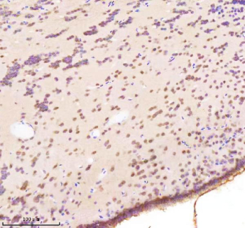 Zebrafish Bap1 Antibody Brain IHC. Immunohistochemical analysis of Bap1 protein using Zebrafish Bap1 antibody and paraffin-embedded zebrafish brain tissue. HIER: boil tissue sections in pH8 EDTA for 20 min and allow to cool before testing.