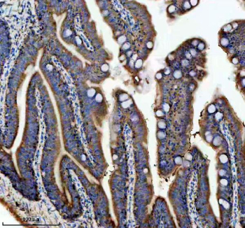 Zebrafish Atp5b Antibody Colon IHC. Immunohistochemistry staining of FFPE zebrafish colon tissue with Zebrafish Atp5b antibody. HIER: boil tissue sections in pH8 EDTA for 20 min and allow to cool before testing.