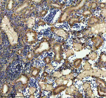 Zebrafish Atp5b Antibody Kidney IHC. Immunohistochemistry staining of FFPE zebrafish kidney tissue with Zebrafish Atp5b antibody. HIER: boil tissue sections in pH8 EDTA for 20 min and allow to cool before testing.